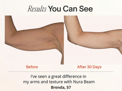 Arm Band