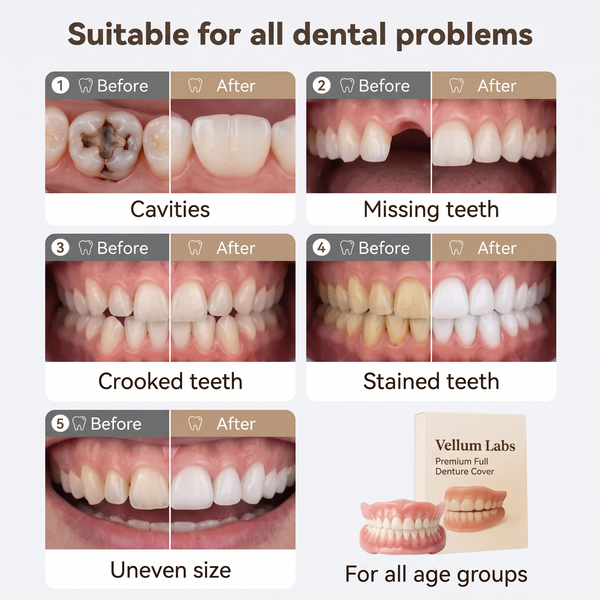 Fits Most Tooth Conditions